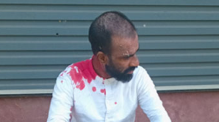 බලපිටියේ වෙඩි තැබීමක්